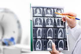 https://dpitm.itb.ac.id/aic/publik/rabmag/image/AI untuk deteksi Covid berdasarkan ctscan dan xray