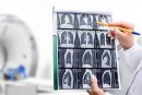 AI UNTUK DETEKSI COVID BERDASARKAN CT-SCAN DAN X-RAY